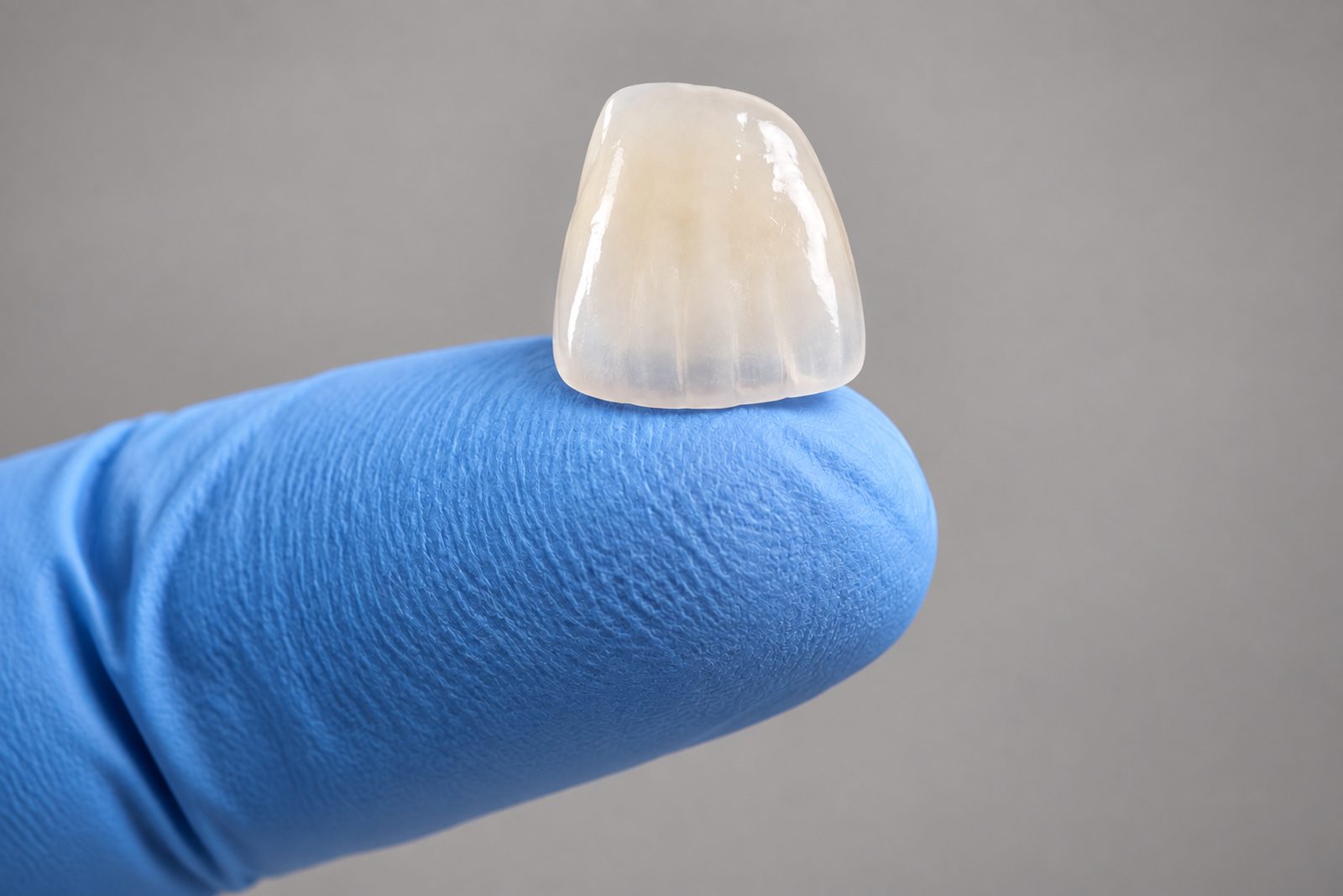 Carilla de cerámica E-max sobre la yema de un dedo enguantado