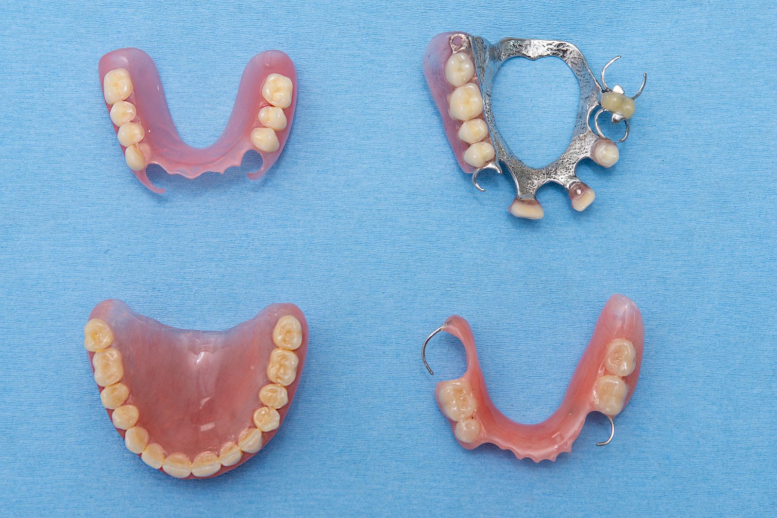 Cuatro prótesis dentales removibles juntas: acrílica, flexible, metálica y total